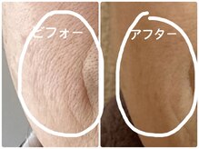 ノーブル シャット Noble Chate/大人女性の毛穴の開き