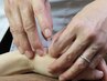 【眼精疲労にお悩みの方】眼精疲労すっきり鍼灸コース 30分 4000円→3000円