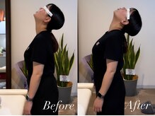 ハクト(Hakuto)/Before/After