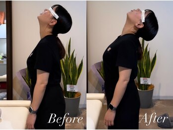 ハクト(Hakuto)/Before/After