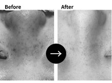 ムーロ バイ ミュー(muro. by mieux)/Before After