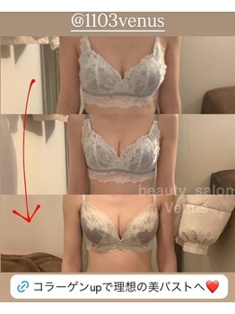 ヴィーナス(Venus)/バストアップ(痩身効果◎整体◎