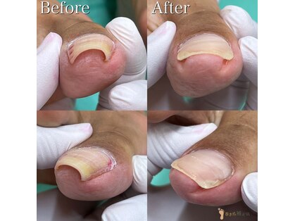 巻き爪補正店 大曽根店の写真