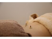 創健鍼灸院の雰囲気（肩こり/マタニティ/産後/鍼灸/藤崎/姪浜/西新/妊活/美容鍼/整体）