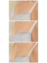 ワム(Wom)/1回毎の変化/2週間に1回施術