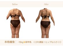 アランルージュ(ALANROUGE)/劇的★ビフォーアフター