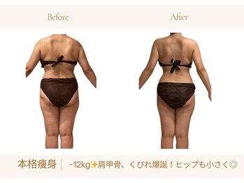 アランルージュ(ALANROUGE)/劇的★ビフォーアフター