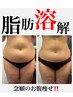 鏡に映る横姿が変わる！脂肪燃焼液使用！Lien式腹部＆ウエスト集中痩身コース
