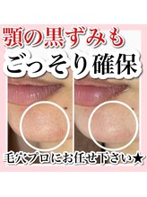 ホワイトアクア 新宿本店(WHITE AQUA)/ララピール/東京/新宿