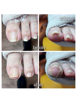 爪切り屋 足楽/