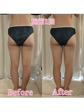 ヨサパーク サーナ 仙川(YOSA PARK Sana)/30代お客様ビフォー⇒アフター