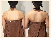 ラフリー 仙台院(RUFFREE)/圧倒的変化を実現【仙台】