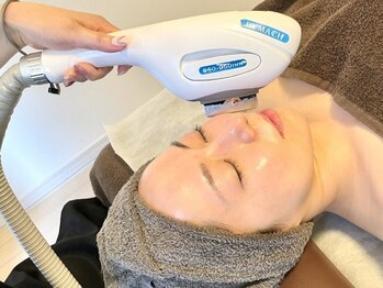 ウィローの写真/むくみ・口元やフェイスラインのたるみ改善へ◎即スッキリが実感できる人気の光フェイシャル◎ハリツヤ肌◎