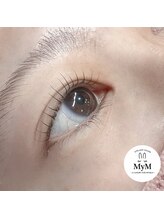 マイム(MyM)/施術例