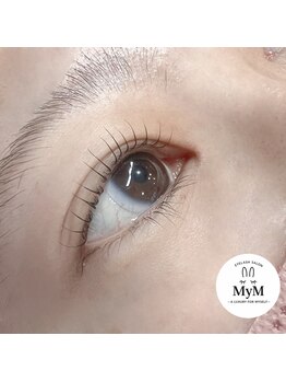 マイム(MyM)/施術例