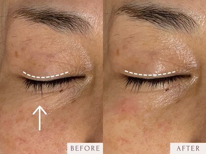 クラームビューティー(Clerm beauty)の写真