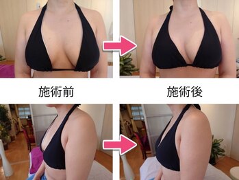 サロンハナ(Salon HANA)/オーダーメイド光バストアップ