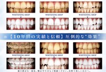 ホワイトニングショップ 鳥取店
