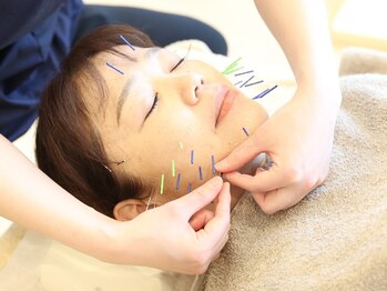 とも苦楽園接骨院の写真/【小顔になりたい方必見！美容鍼灸¥5500→¥3500♪】通いやすいお手頃価格で小顔ケアができます◎