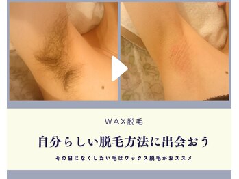アール ピヴォワンヌ(R.pivoine)/≪脇≫ワックス脱毛