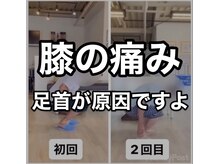 カワル整体 上通り院/膝の痛みは足首から？