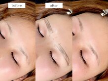 エムドット(m.)/アイブロウワックス脱毛