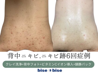ビズビズ 梅田店(bisebise)の写真