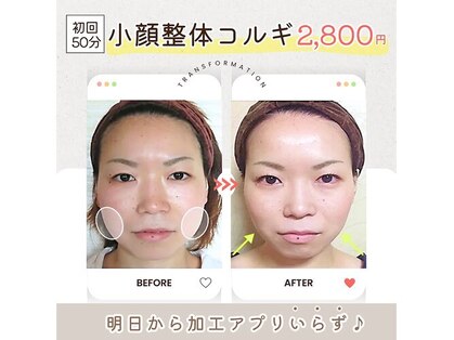 小顔整体研究所 KSラボ 梅田店の写真