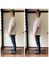 ミントのかべの整体院/施術ビフォーアフター