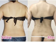 グラウディア 恵比寿/痩身/筋膜リリース/インディバ超