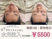 マヴィ 香里園店(MavY.)/結果に繋がる水光注入☆