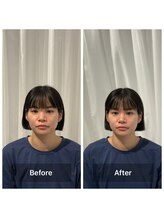 美容整体プラスフィール 恵比寿本店/小顔・顔の左右差・リフトアップ
