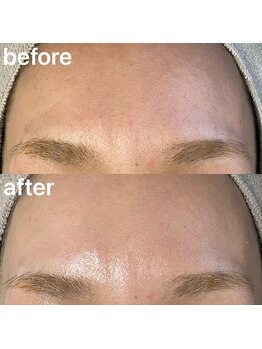 エイミー(Amy)/Before&After