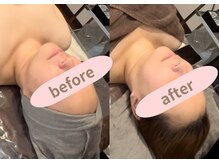 シェリール(Cherir)/肌質改善プレミアム