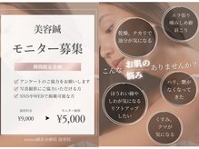 ネクサス(NEXUS)