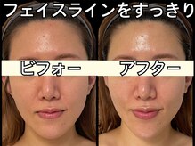 ココ(COCO)/フェイスラインをすっきりさせる