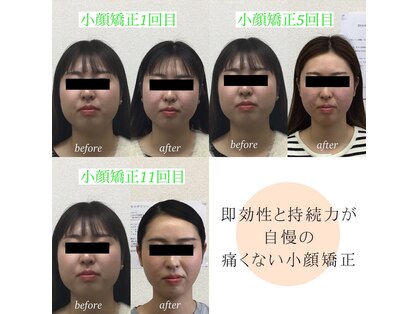 オズ六本木の写真