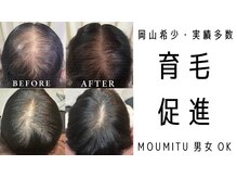 スカルプラボ 倉敷店(Scalp Lab)