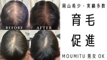 スカルプラボ 倉敷店(Scalp Lab)