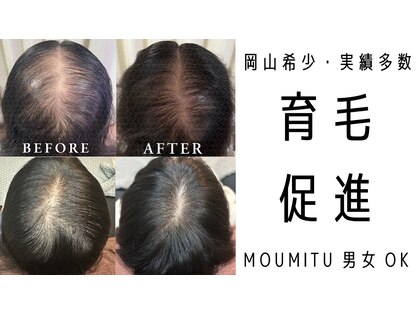 スカルプラボ 倉敷店(Scalp Lab)の写真