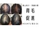 スカルプラボ 倉敷店(Scalp Lab)の写真