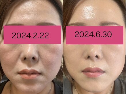 第1印象120%UP!!全ての肌悩みに】韓国式スキンケアで輝く美肌を手に 