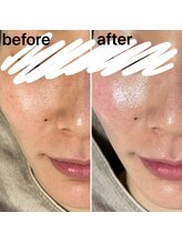 エイミー(Amy)/Before&After