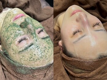 ディアーム 光明池店(Diarm)の写真/【剥離しないハーブピーリング】仕上がりに満足＆お肌の弱い方も◎肌本来の美しさを引き出します♪