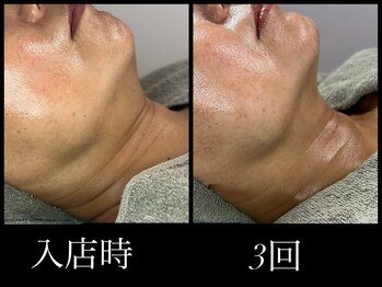 ビーエルティー(blt)/レモンボトル