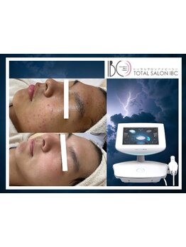 お肌をきれいにしたい