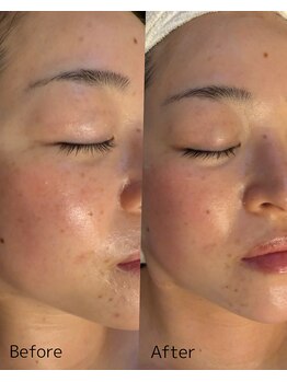 ダイダイ(daidai)/before→after　3回目