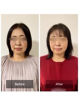 チル(Chill.)/美容整体×小顔整顔で月1ケア☆