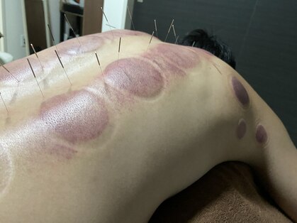 エザキ鍼灸院 接骨院(EZAKI鍼灸院 接骨院)の写真