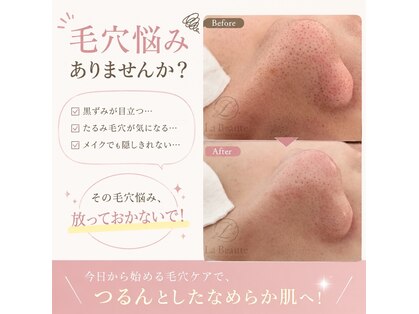 ｂｅｂｅの写真